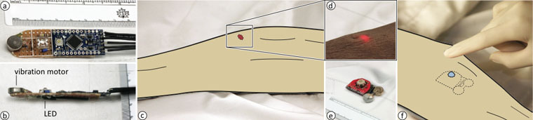 Implanted User Interfaces: Figure 1