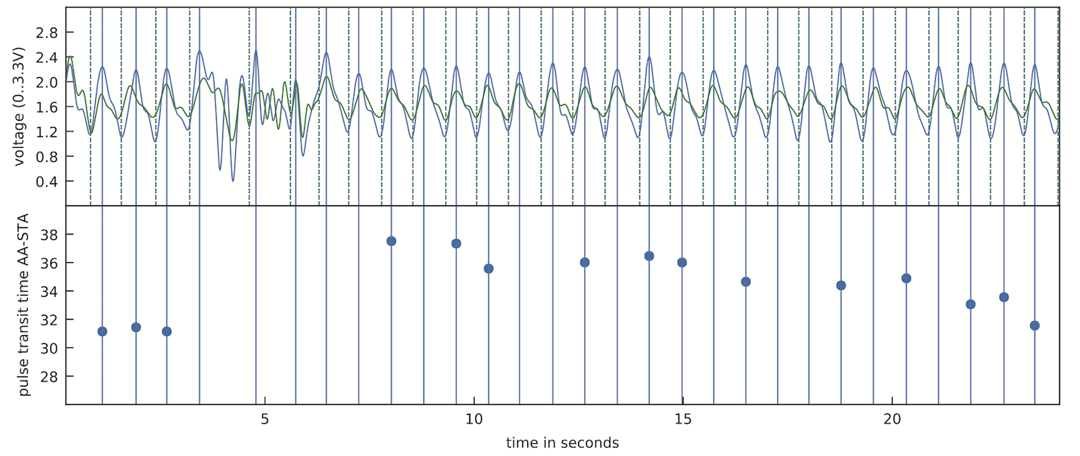 Glabella: Figure 13, pulse transit time values in reponse to getting up, reflecting a drop in blood pressure