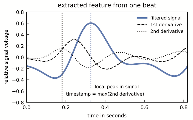 Glabella: Figure 11, temporal features extracted from the filtered pulse reflections