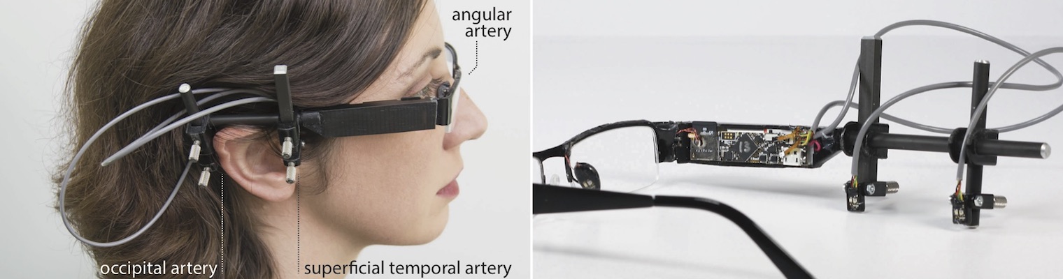 Glabella: Figure 14, study apparatus with adjustable sensor locations