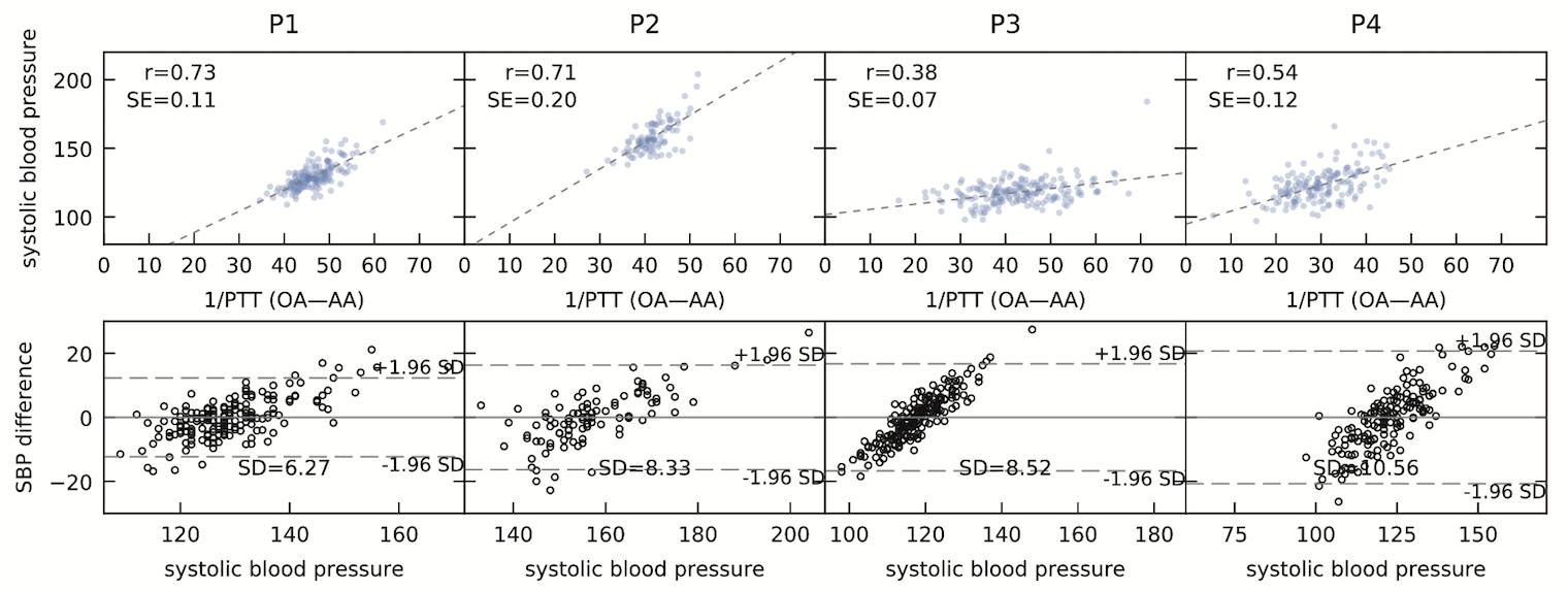 Glabella: Figure 20, correlation plot and Bland Altman plot for measured systolic blood pressure values and pulse transit times between the angular artery and the occipital artery