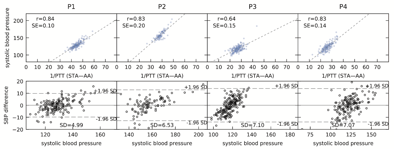 Glabella: Figure 19, correlation plot and Bland Altman plot for measured systolic blood pressure values and pulse transit times between the angular artery and the superficial temporal artery